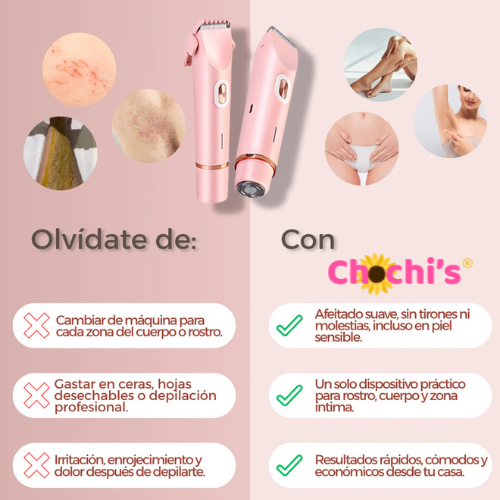 Depiladora Chochi's®